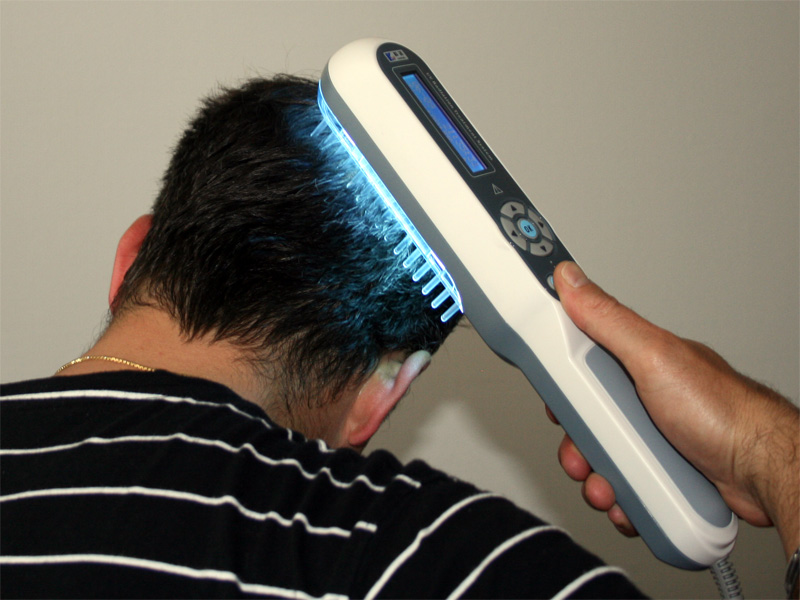 uvb lamp psoriasis